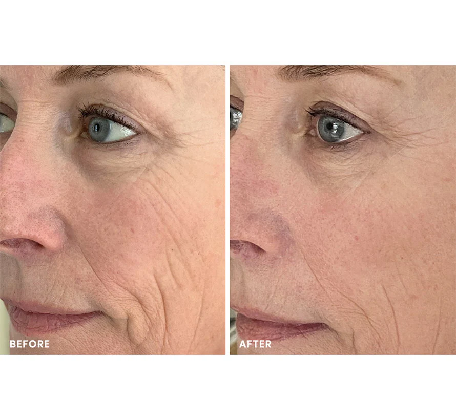 8 MINUTE MASK - Image 15